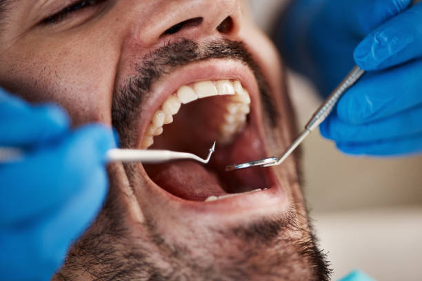 Best Dentist for Tooth Abscess  in Delta, OH